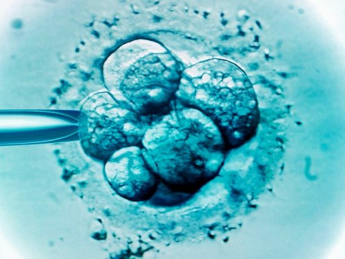 Scientists say they have created 'embryos' without sperm or eggs