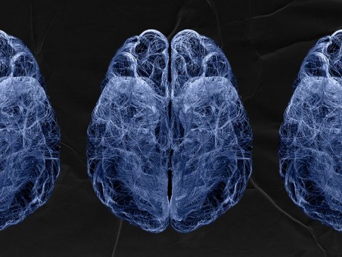 Alzheimer's: How brain immune cells can slow down progression
