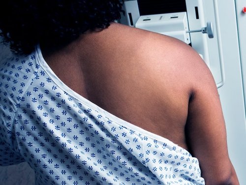 Breast calcifications: Causes, when to see a doctor, and diagnosis