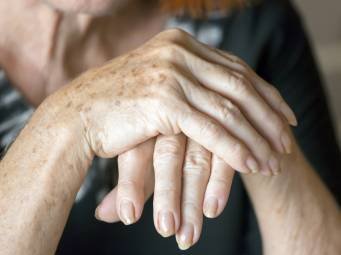 Could vitamin D help to keep rheumatoid arthritis at bay?