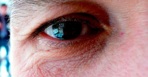 Yes, Some Men Are Really Shaving Their Eyelashes Off