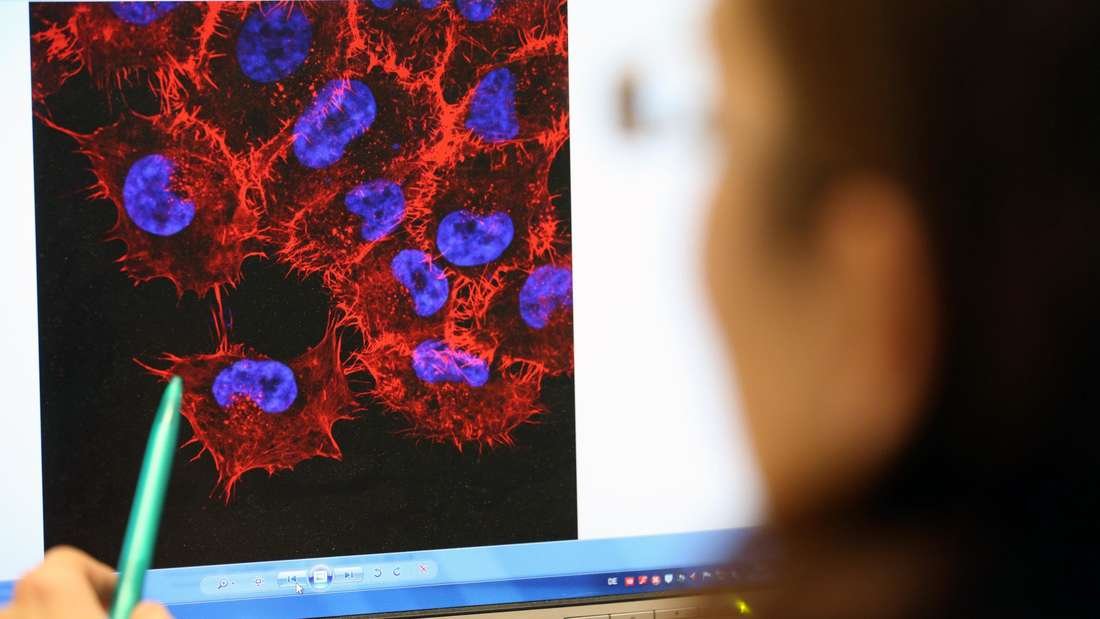 Krebsrisiko in Deutschland verringern: Angewohnheit könnte 30.000 Diagnosen pro Jahr verhindern