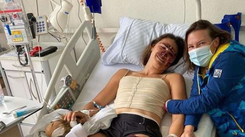 Ski-Star nach Sturz schwer verletzt - sie zeigt erschreckende Bilder aus Klinik