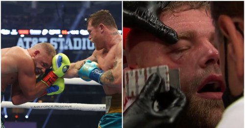 Billy Joe Saunders rushed to hospital with gruesome eye injury following defeat to Canelo Álvarez