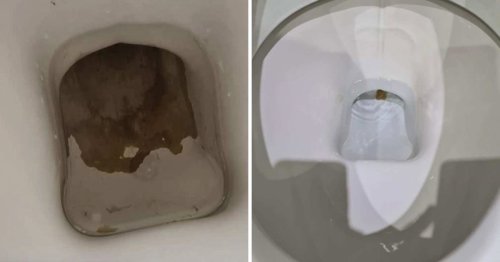 Woman says this £2 cleaning product gets rid of ’embarrassing’ limescale stains in the toilet in 30 minutes