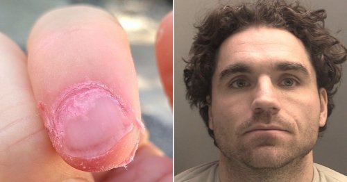 Drug dealer caught ‘pink-handed’ when photo showing just his fingers exposed him