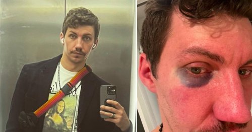Gay man beaten up for simply having fun in the park