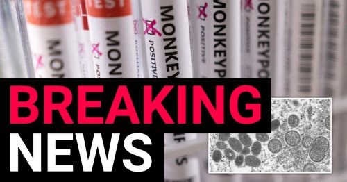 Number of people with monkeypox in UK jumps to 78