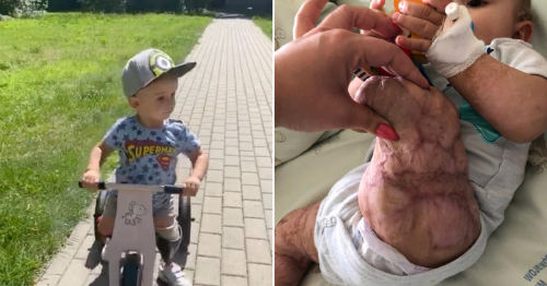 Toddler who had both legs amputated due to sepsis learns to ride a bike for first time