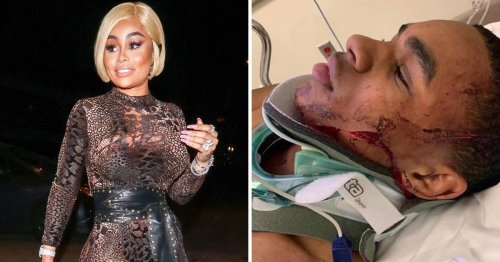 Blac Chyna’s ex YBN Almighty Jay beaten up and robbed in live-streamed street fight