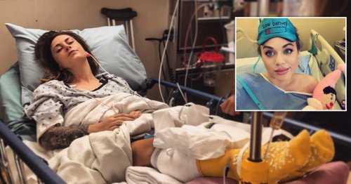 Woman Almost Loses Both Her Legs After Falling Asleep Drunk Flipboard