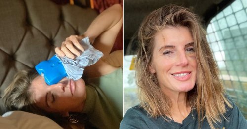 Our Yorkshire Farm star Amanda Owen sports black eye after being ‘headbutted by sheep’