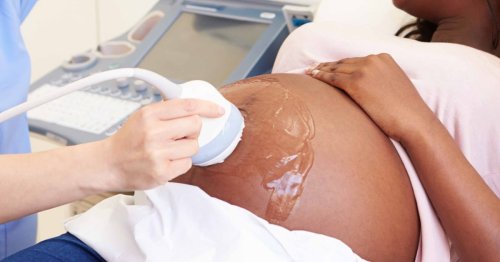 ‘Systemic racism in maternity care’ uncovered in year-long inquiry