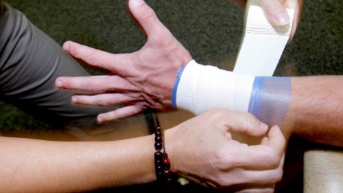 Wrist fracture after fall may need surgery to align bones and regain range of motion