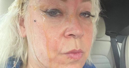 Midwife pelted with eggs and flour by mindless yobs as she drove to see patients