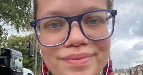 Woman’s face blew up from tomato allergy ‘when Pizza Hut got her order wrong’