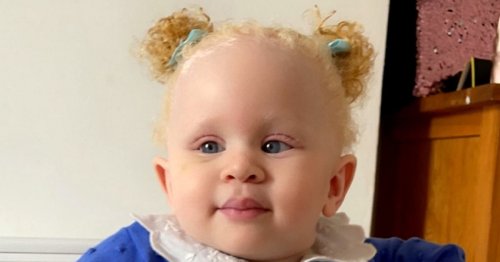 Albino baby suffers vile racist abuse as Black father is forced to 'prove' he is her dad