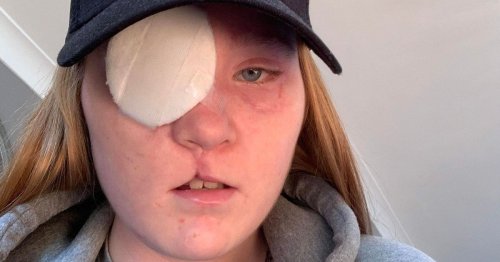 Woman whose head was crushed by 21-tonne excavator at work tells of horrific injuries