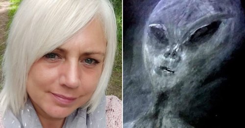 Gran says she’s been abducted by aliens 50 times – and has bruises to prove it