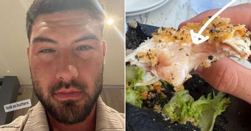 Love Island's Liam Reardon unrecognisable after extreme allergic reaction to raw chicken