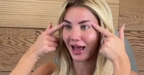 Love Island's Grace Jackson divides worried fans as she plans 'unnecessary' tweakment