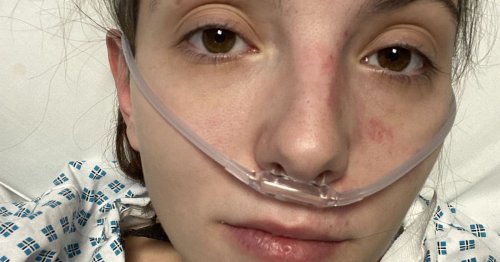 Disney fan's urgent op after B&M glass explodes leaving shards in mouth
