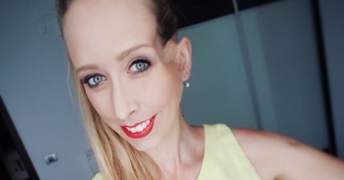 Mum lives with huge dent in head carved out to save life from 1-in-a-million skin cancer