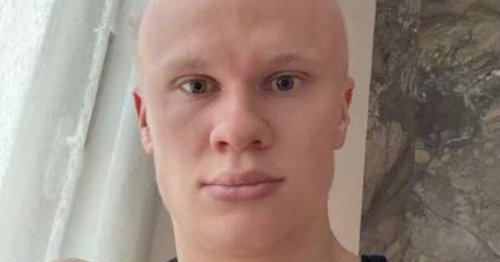 Erling Haaland 'goes bald' as Man City star tests out radical new look