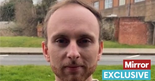 Man who went bald in 20s in tears as revolutionary treatment 'takes decades off'