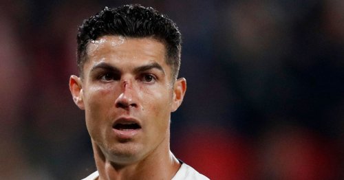 Man Utd news: Cristiano Ronaldo suffers nasty injury on international duty
