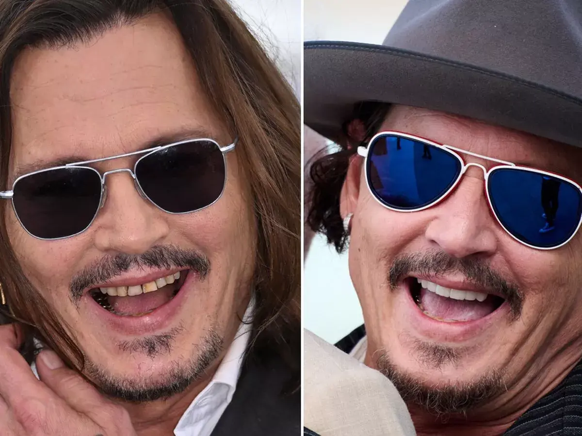 Johnny Depp once said he'd 'rather swallow a tick' than have his teeth ...