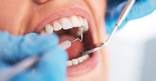 dentist-reveals-7-early-signs-of-mouth-cancer-as-cases-hit-record-high