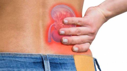 Causes, symptoms and treatment of kidney stones: Check salt intake, avoid chicken, drink lot of water