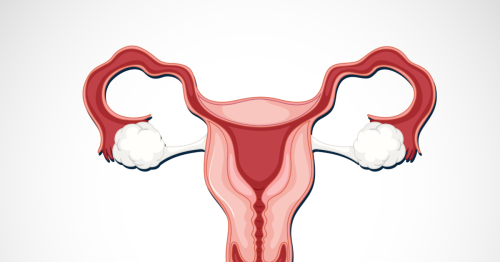 No es lo mismo tener quistes ováricos que síndrome de ovario poliquístico (SOP)