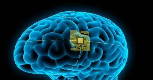 Un implante cerebral logra eliminar la depresión