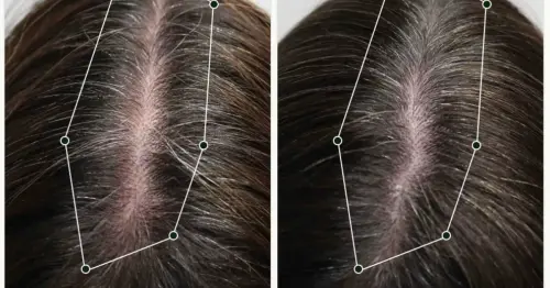 Hair growth serum leaving hairdressers 'really impressed' when 'nothing else works'