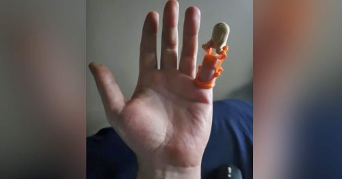 Man Gets a New Prosthetic Pinkie From Redditor With a 3D Printer After Insurance Let’s Him Down