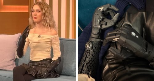 “Bionic Girl” Debuts New Wireless Hands That Even Work When Detached From the Main Prosthetic