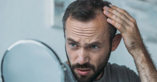 Scientists From UCLA May Have Discovered a Cure for Hair Loss