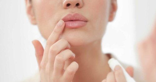 Rissige Lippen im Winter? Mit diesen 7 Tipps vermeidest du sie