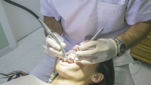 Wie nützlich ist eine professionelle Zahnreinigung?