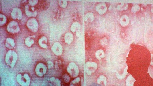 "Die vierte Phase der Epidemien"