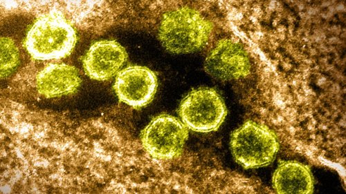 Lauterbach sieht Coronavirus "in der Sackgasse" 