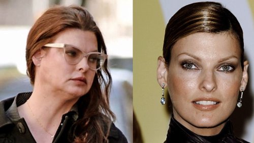Linda Evangelista fühlt sich deformiert