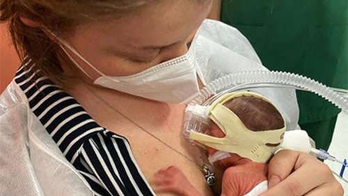 "Miracolo" in ospedale: nasce bimba di soli 600 grammi
