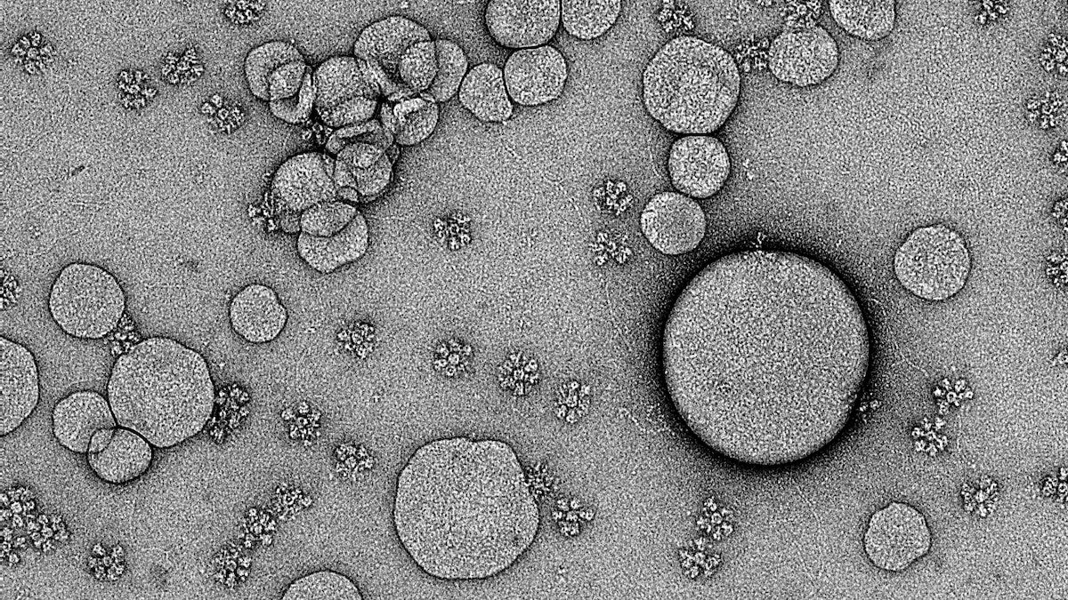 Is a universal coronavirus vaccine on the horizon?