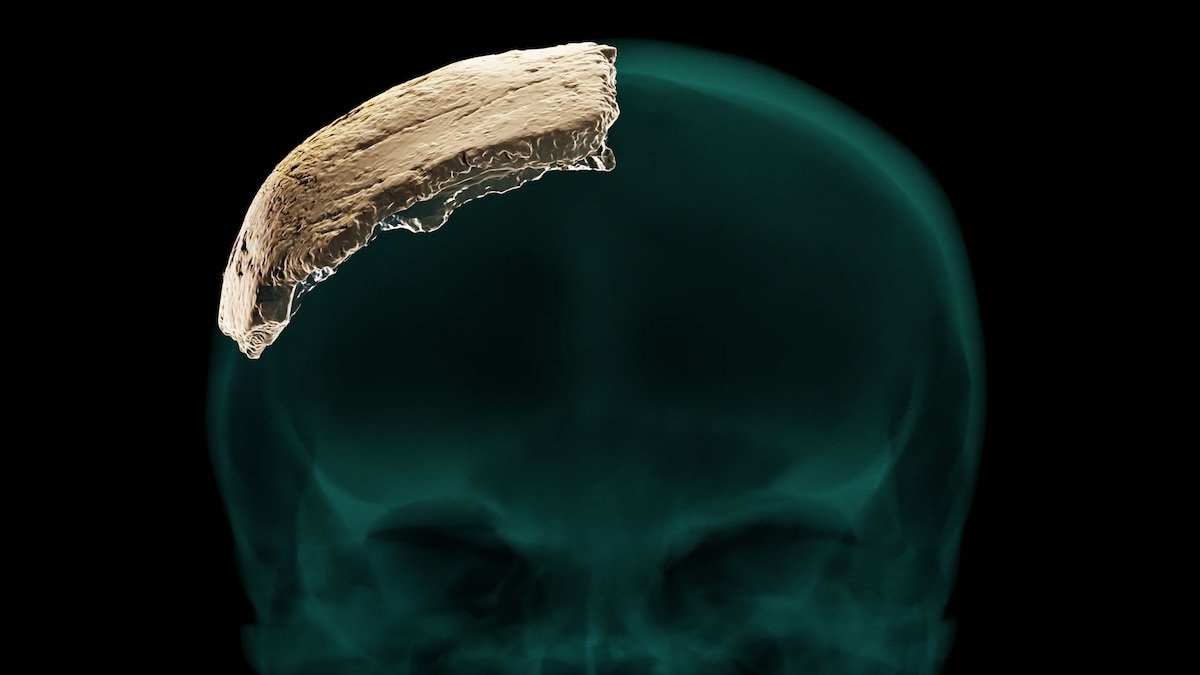 Puzzling skull discovery may point to previously unknown human ancestor