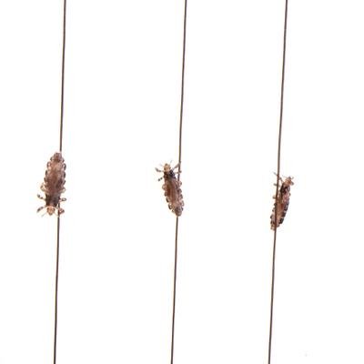Woher kommen Kopfläuse – und wie wird man sie wieder los?