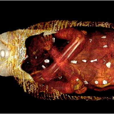 Mumienforschung: Erster Blick unter die Maske des „Goldenen Jungen“
