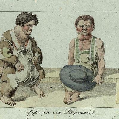 Qui étaient vraiment les crétins des Alpes ?